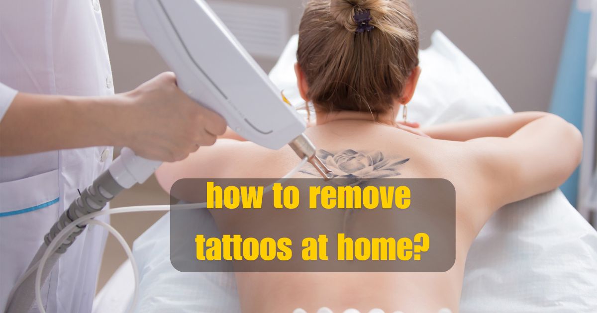 remove tattoos